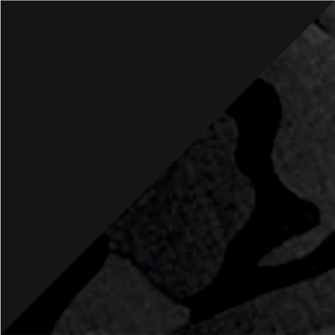 midnight camo/black